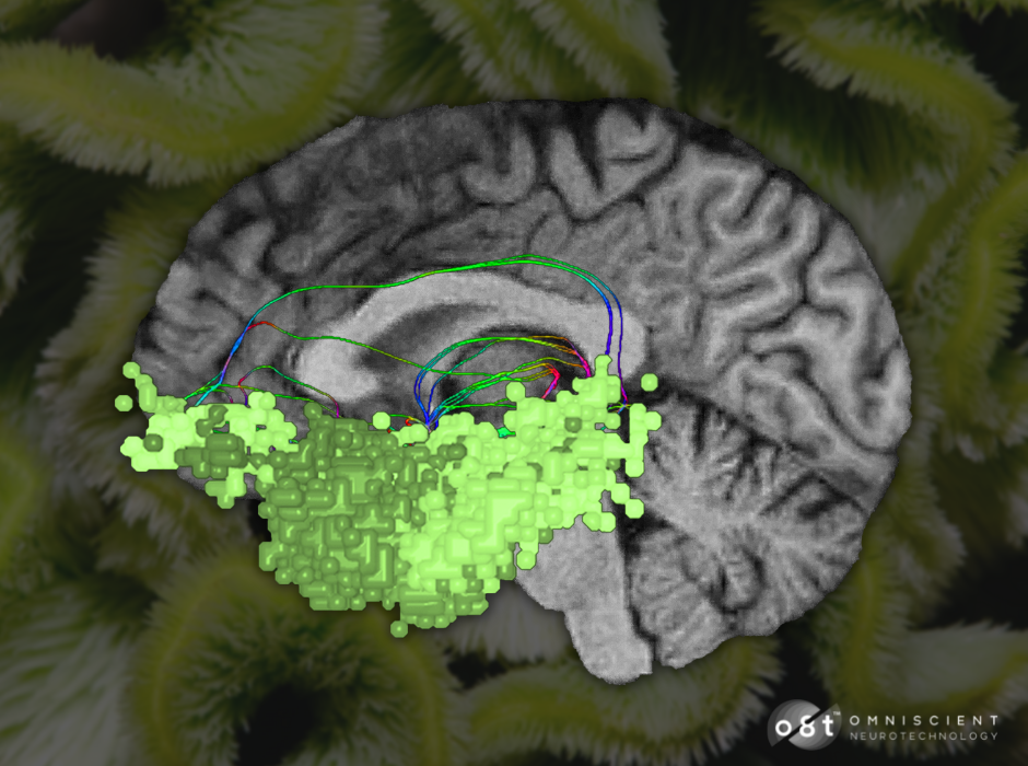 The Limbic System